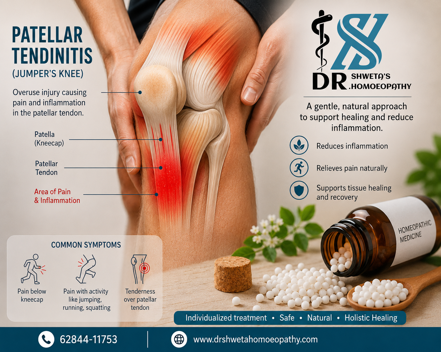 Homoeopathy for Patellar Tendinitis: Natural Relief for Jumper's Knee in Athletes